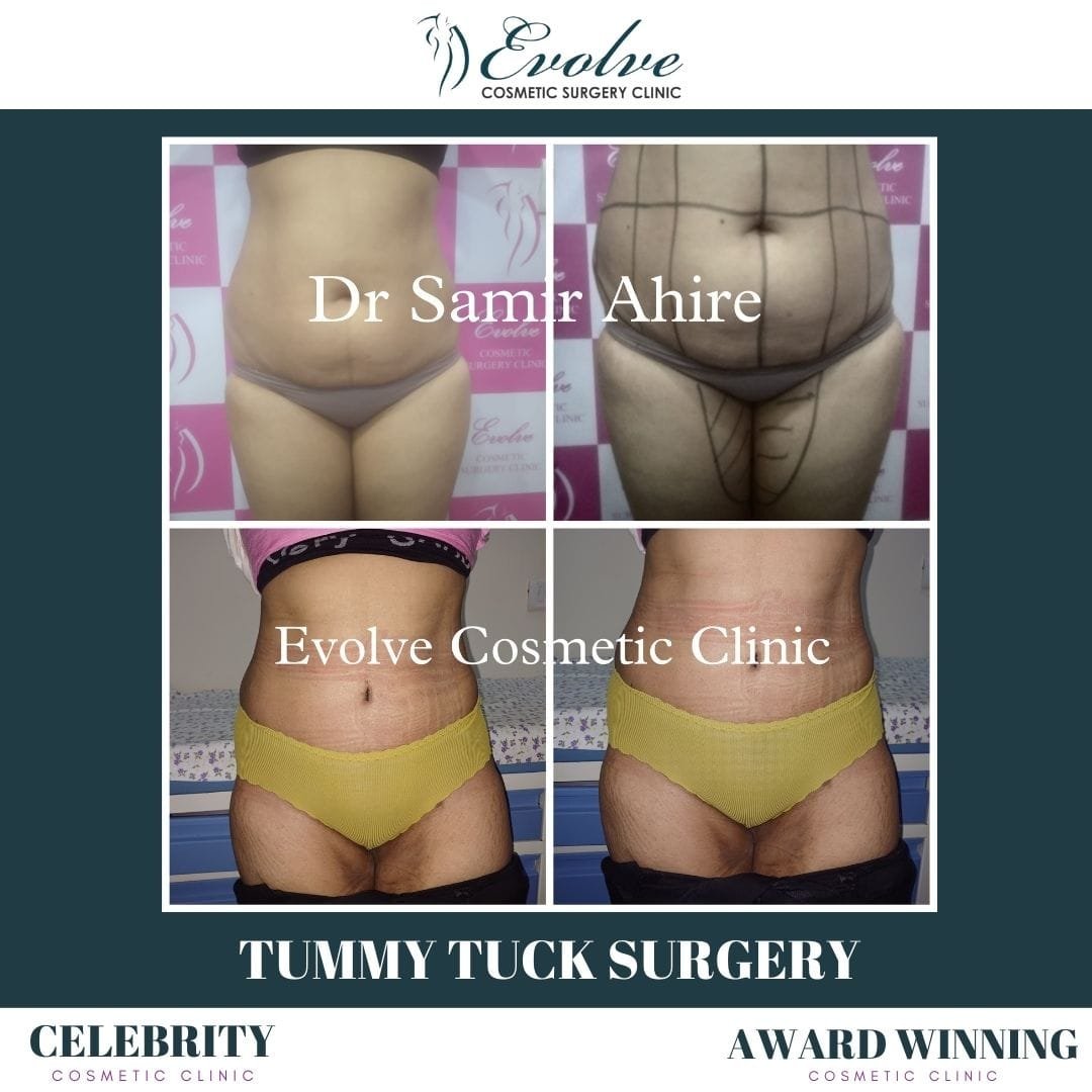 Plastic Surgeon Consultation